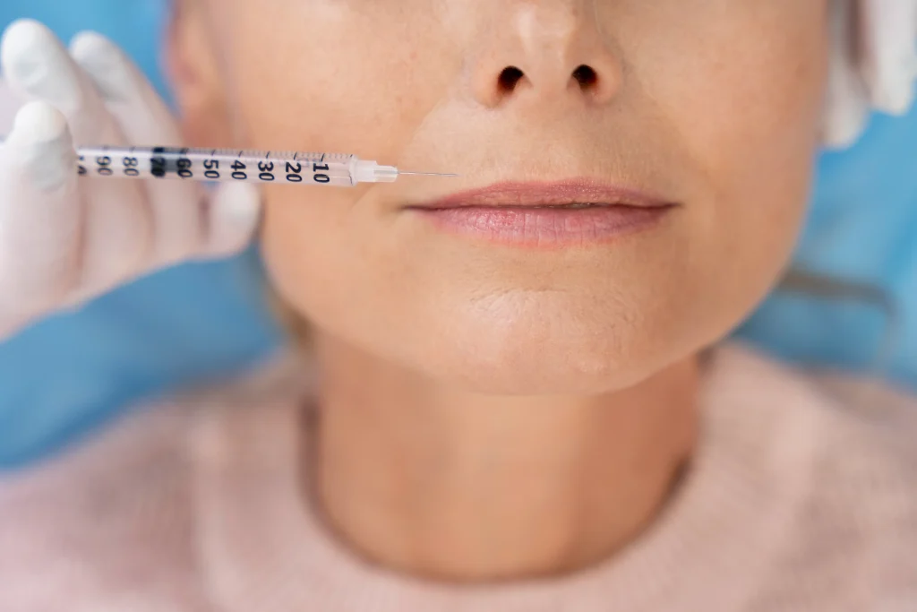 Lip filler volume enhancement treatment in Hobart at Heart Aesthetics for natural, fuller lips