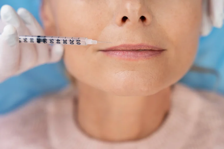 Lip filler volume enhancement treatment in Hobart at Heart Aesthetics for natural, fuller lips