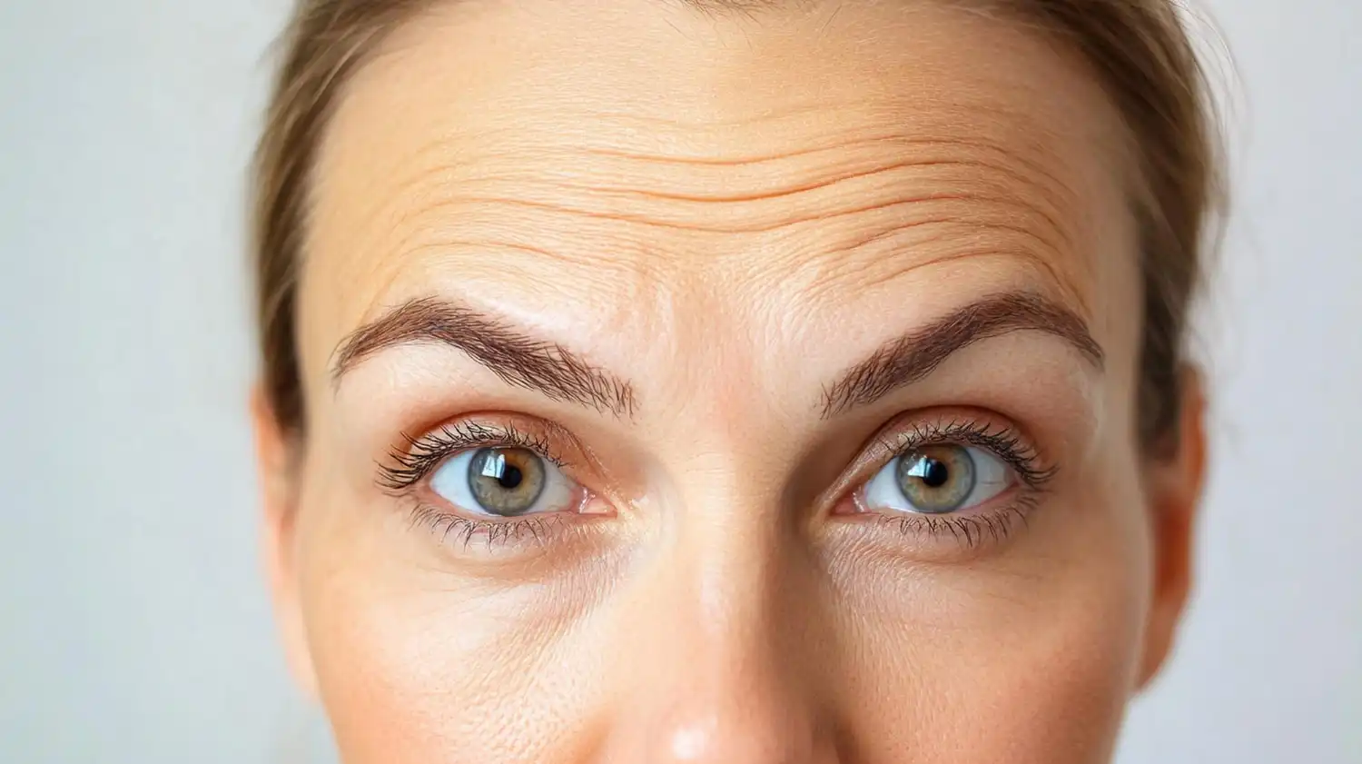 Forehead wrinkle injections in Hobart offering advanced cosmetic therapies for smooth and youthful skin.