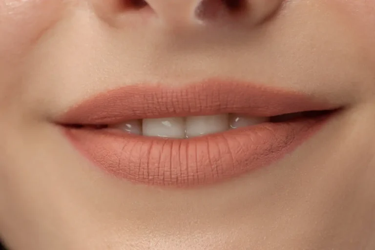 Lip symmetry and volume filler treatment in Hobart at Heart Aesthetics.