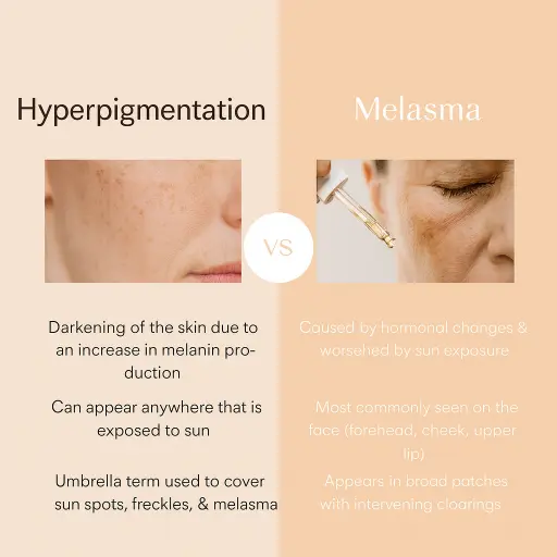 Melasma in Australia