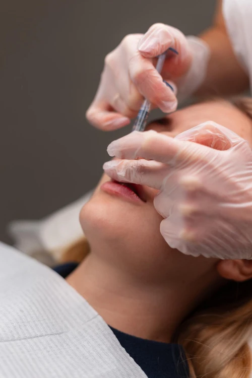 When to top up dermal fillers for longest results Hobart