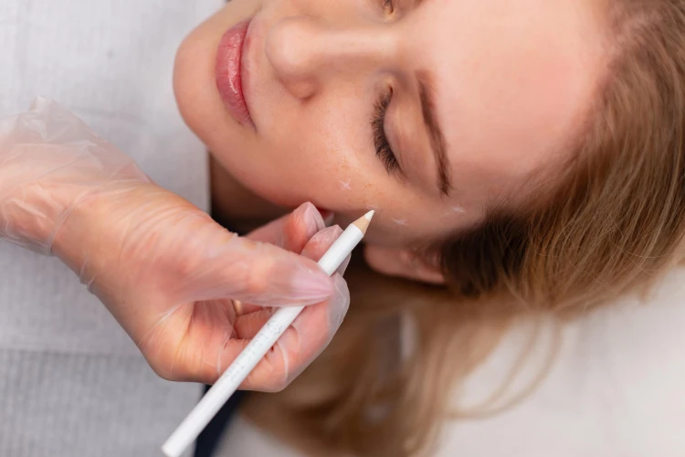 Lip filler longevity compared to cheek filler in Hobart