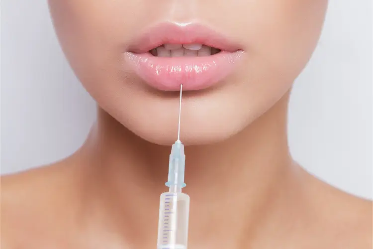 Before and after lip filler results in Hobart