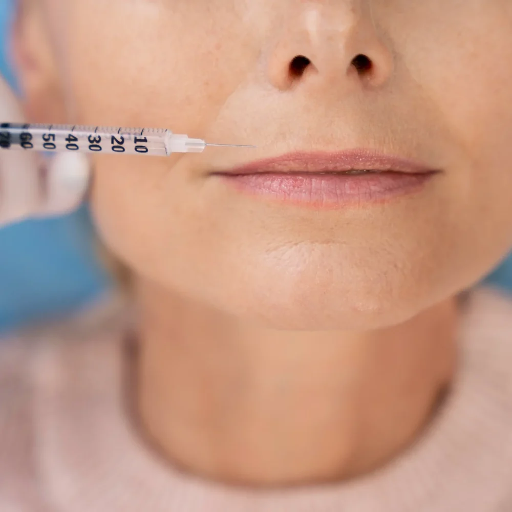 Lip filler volume enhancement treatment in Hobart at Heart Aesthetics for natural, fuller lips