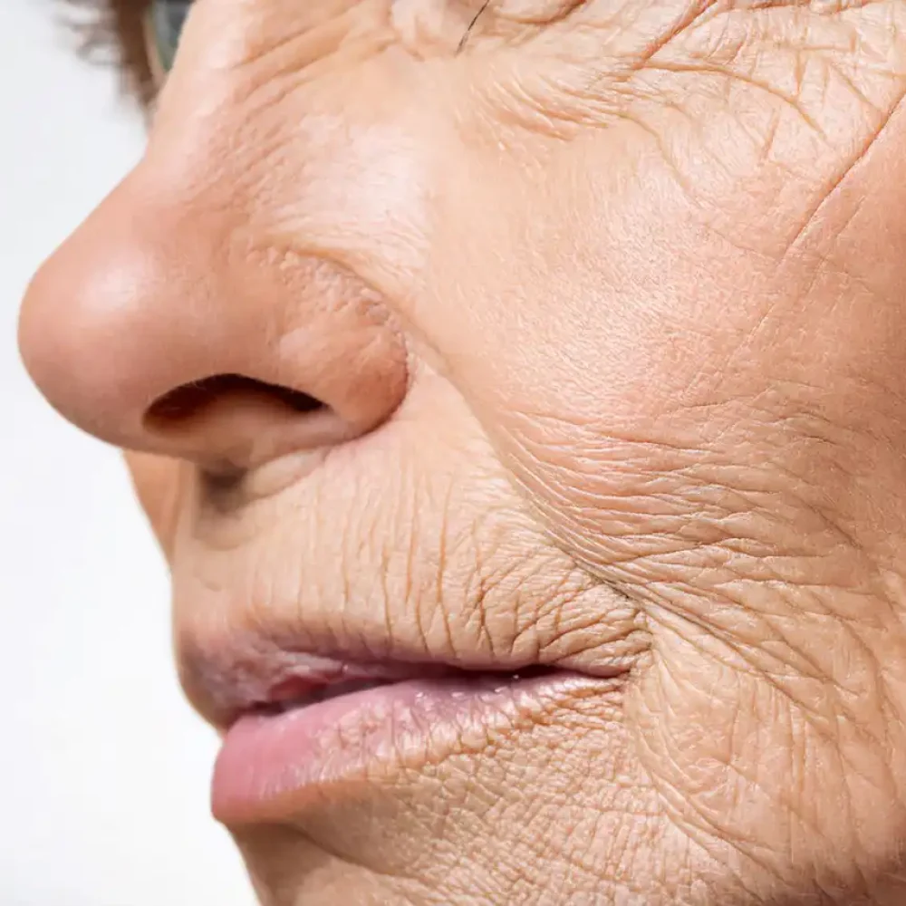 Fine lines and wrinkle treatment in Hobart at Heart Aesthetics for smoother, youthful skin